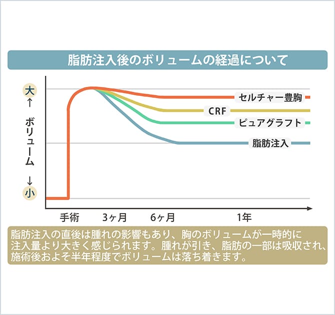 脂肪注入後のボリュームの経過について