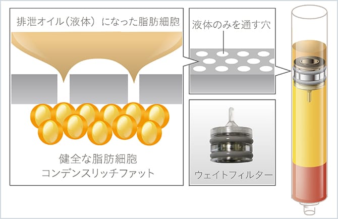 コンデンスリッチファットと排泄オイル(トリグリ)を分離する図