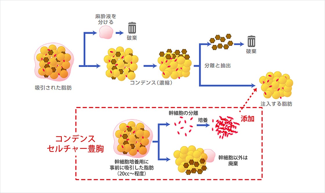 分離までのプロセスの図