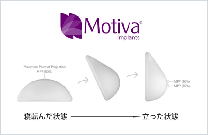 Motiva使用イメージ