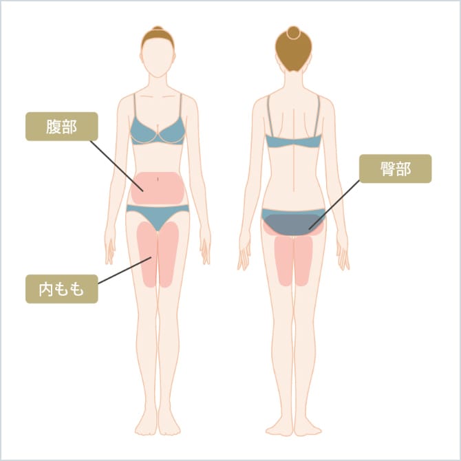 自分の脂肪を採取して注入