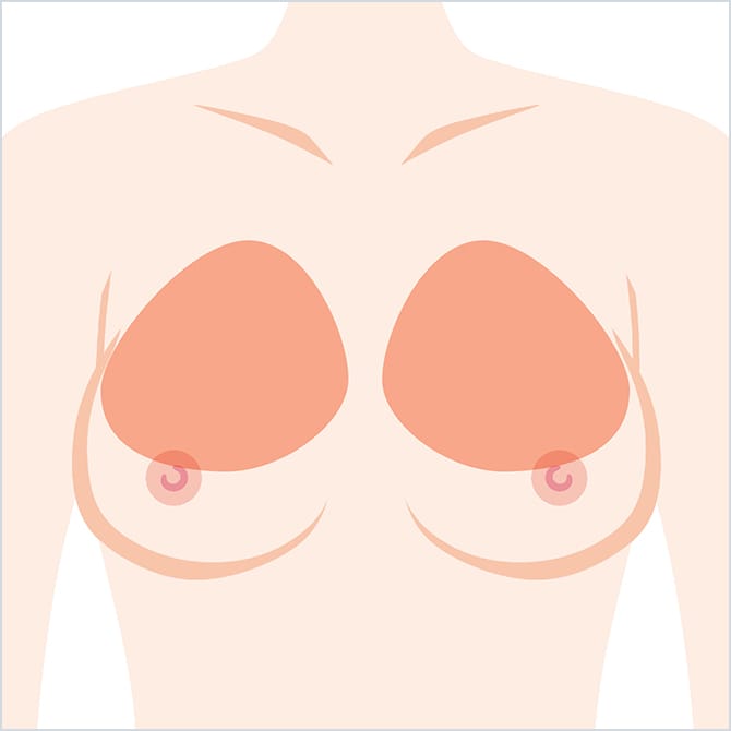 デコルテアップ