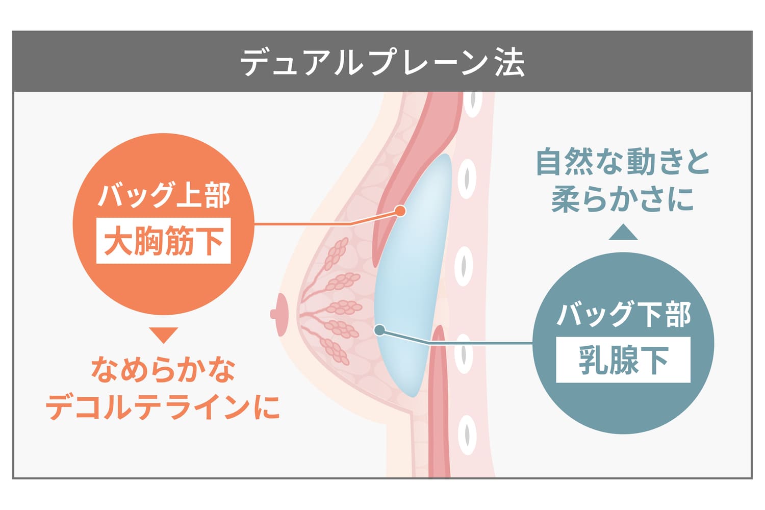 痩せ型でも自然な仕上がり！デュアルプレーン法