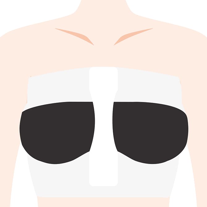 シリコンバッグ挿入の完了後