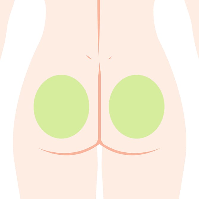 シリコンバッグ挿入位置の図 お尻