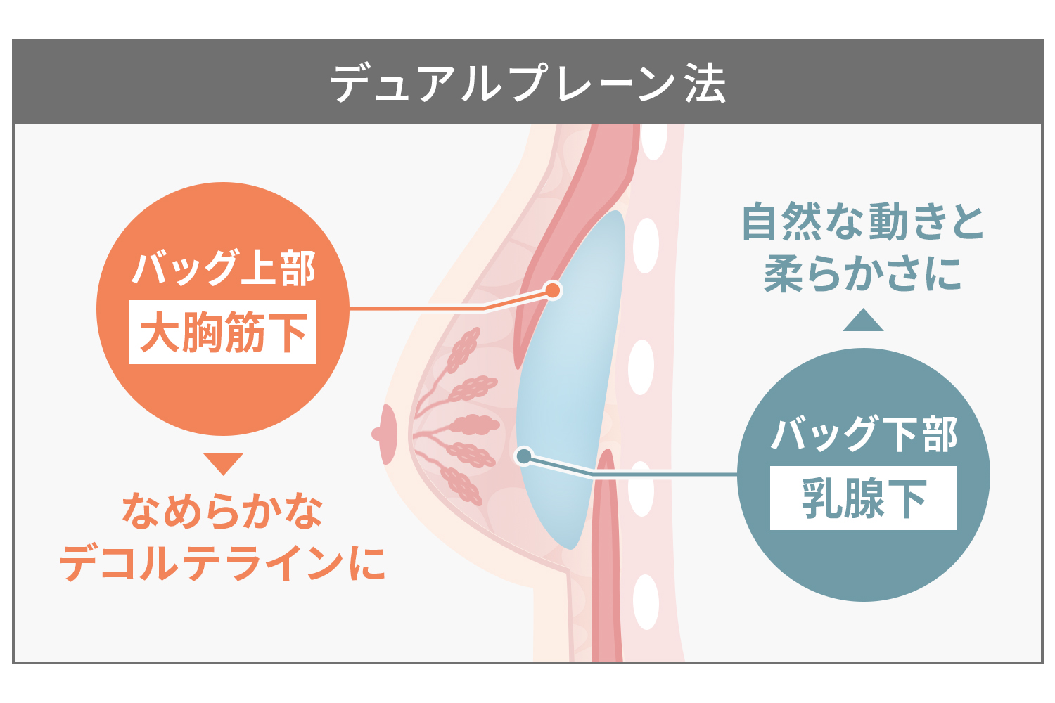 デュアルプレーン法