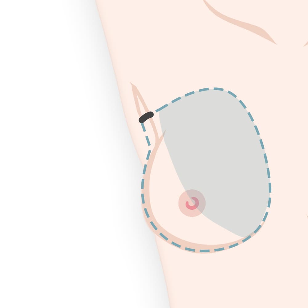 剥離してスペースを作る