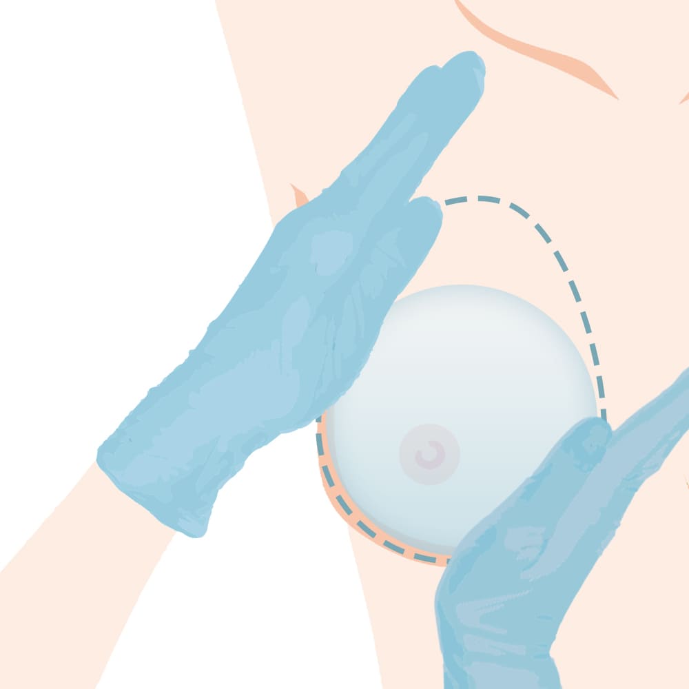 バッグ位置の調整