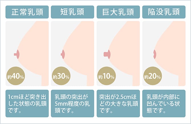 乳頭の種類とその比率