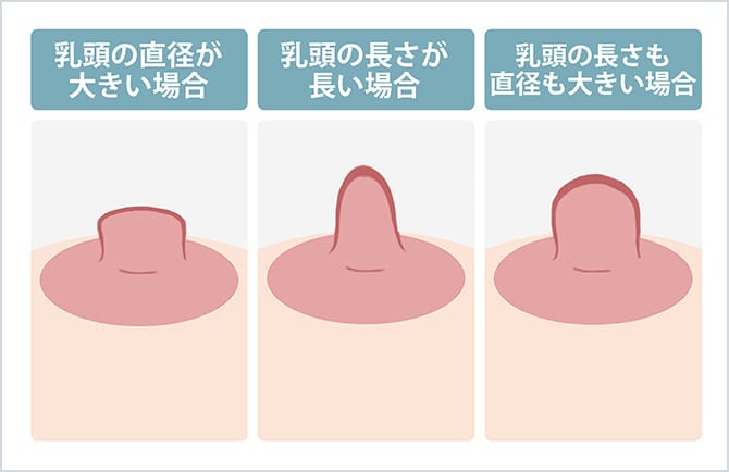 乳頭の形状