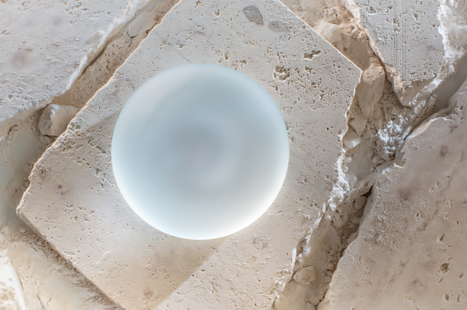 インプラントの選定