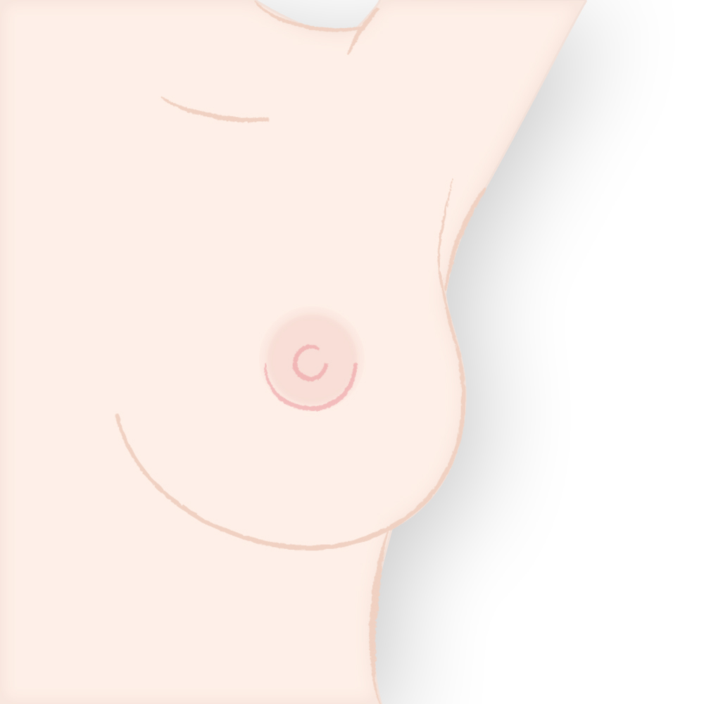 切開部の縫合・固定