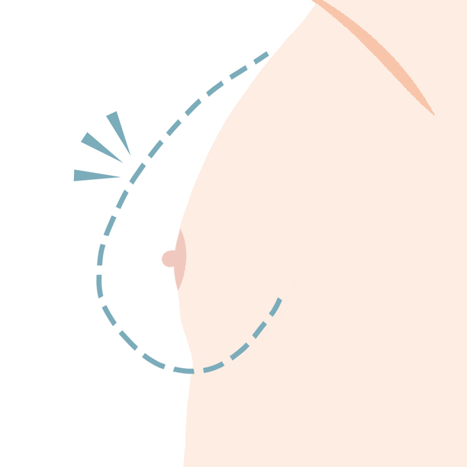 短期間でなくなる