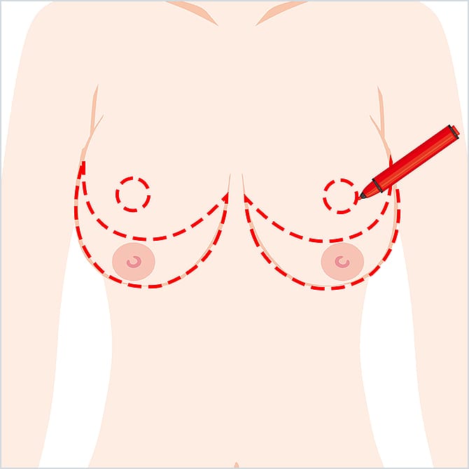 胸にマーキングするイラスト