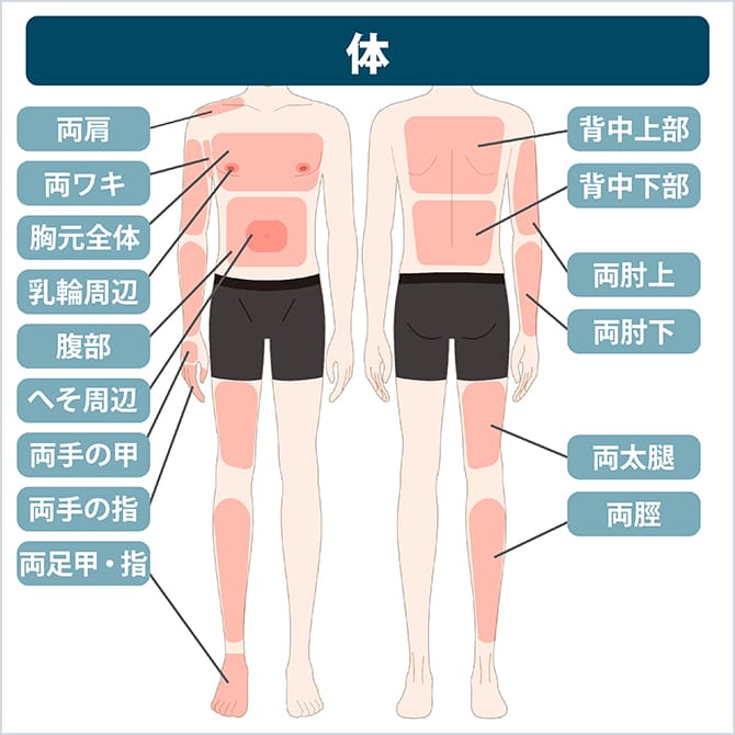 体の施術部位の図