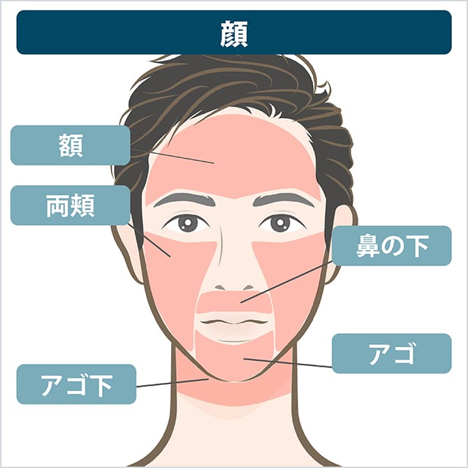 顔の施術部位の図