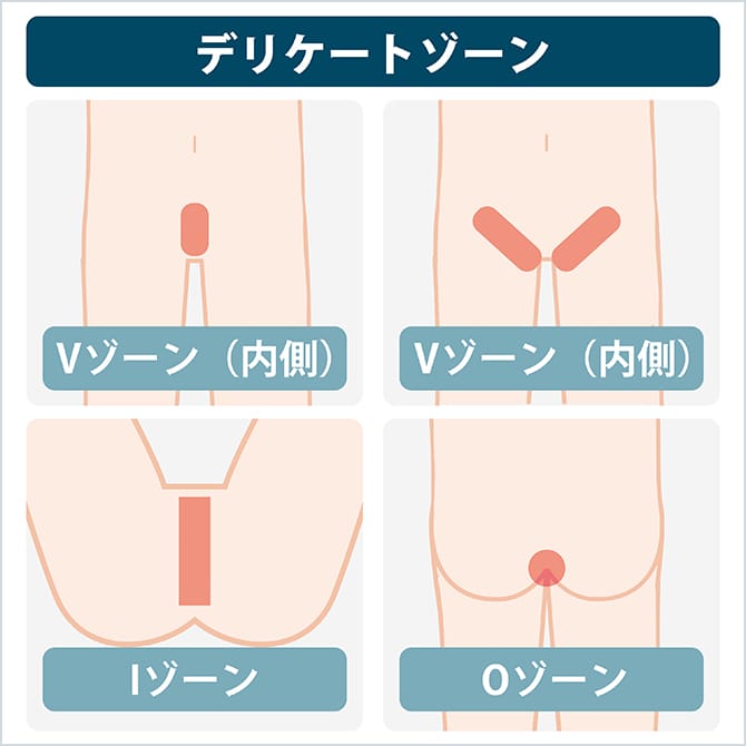 デリケートゾーンの施術部位の図