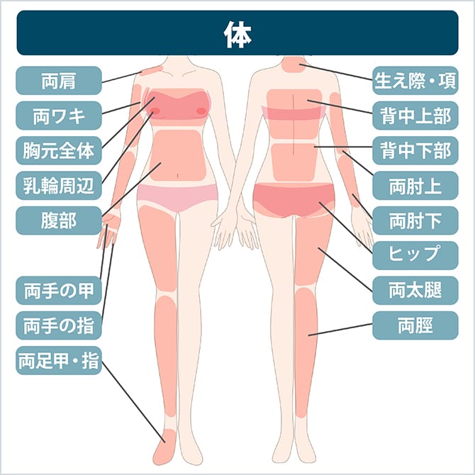 体の施術部位の図