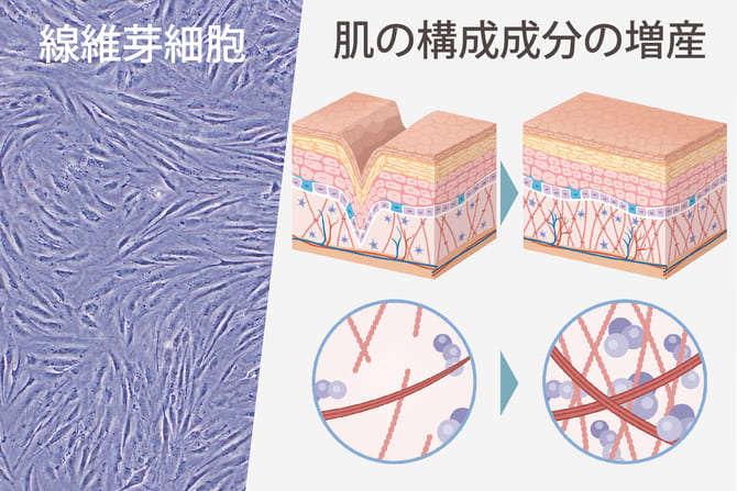 繊維芽細胞を増やす成長因子であるFGFを注入することで皮膚の弾力を取り戻すイメージ