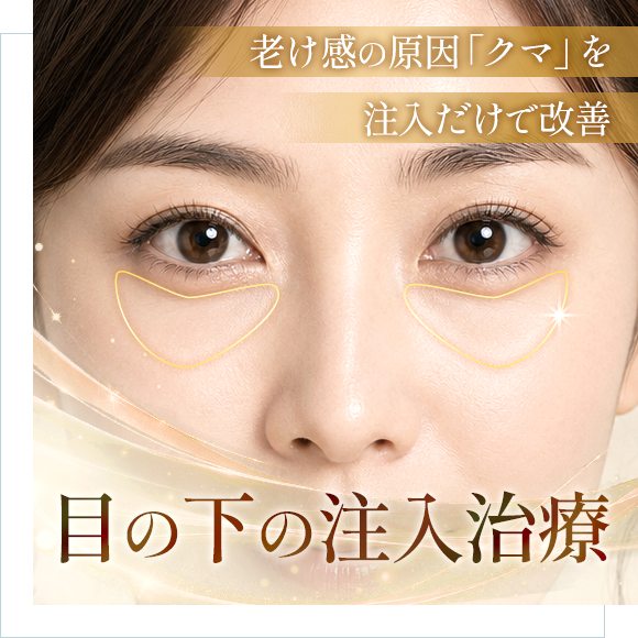 目の下の注入治療（クマ治療）