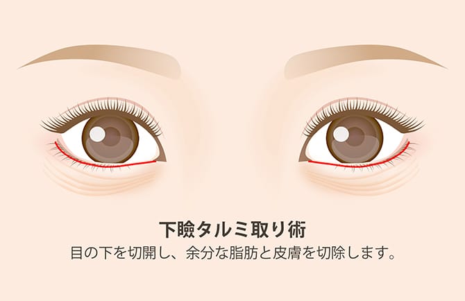 Cpt3ebgndnhqkm Cpt3ebgndnhqkm