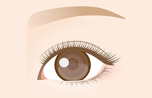 上まぶたが黒目より上位置