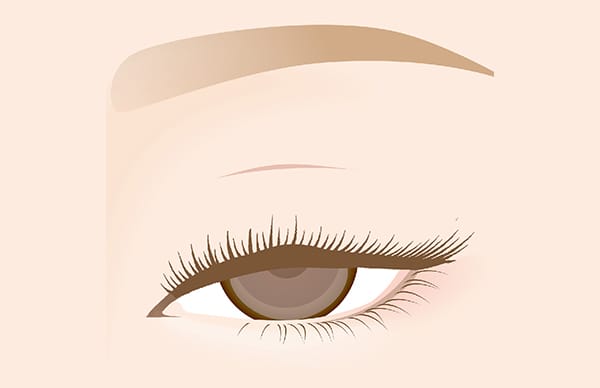 上まぶたが黒目の真ん中より下まで被さっている