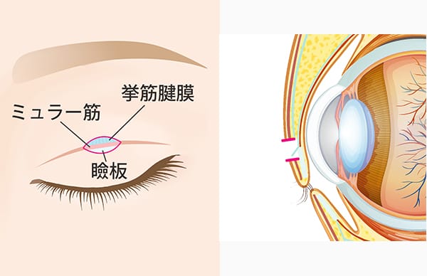 瞼板、挙筋腱膜、ミュラー筋