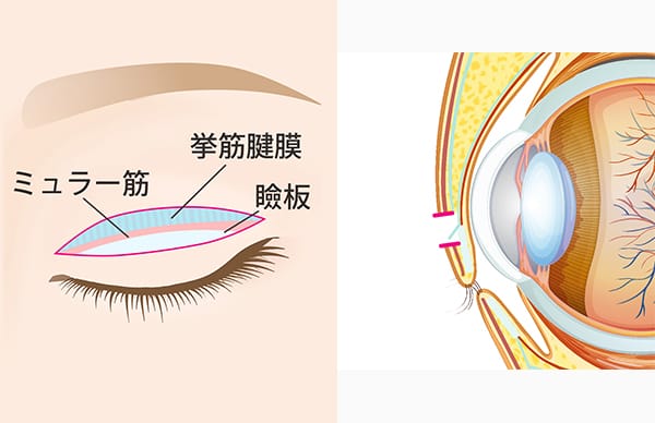 瞼板、挙筋腱膜、ミュラー筋