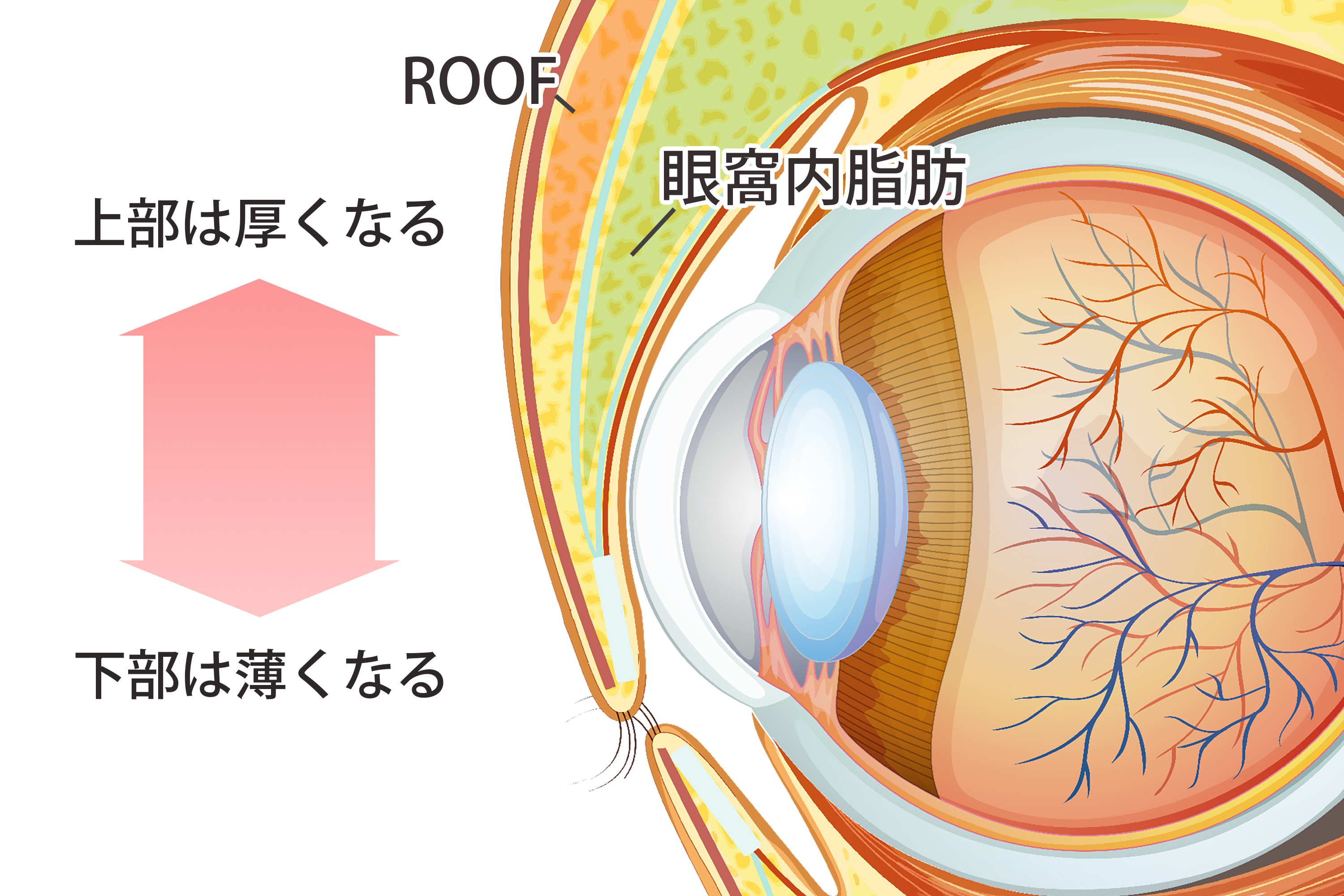 まぶたの脂肪の断面図