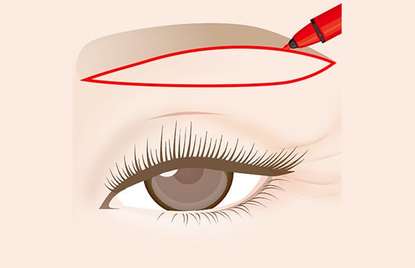 眉下ラインにマーキング