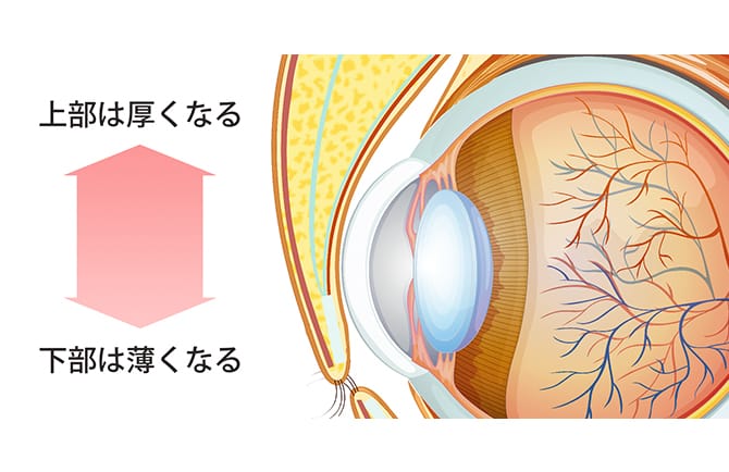 まぶたの脂肪の付き方の断面図