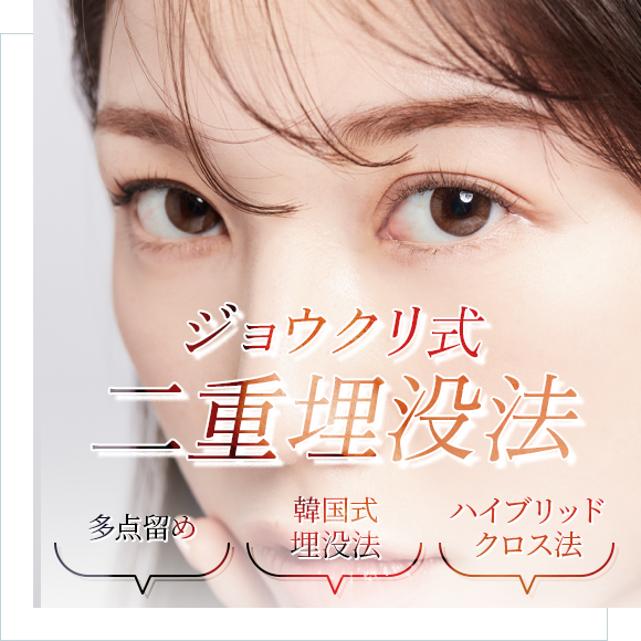 初めての二重術にもオススメ!切らずにパッチリ二重まぶた 戻りにくく、美しい二重ラインを 二重埋没法