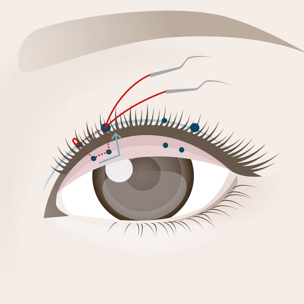 糸を出した位置と同じ位置にもう片側の糸を出す