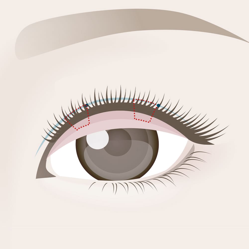 留めの数だけ繰り返す