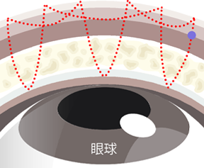 韓国式6点留め