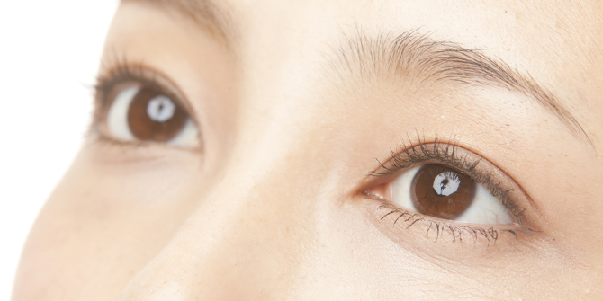 腫れにくく取れにくい特殊な二重術