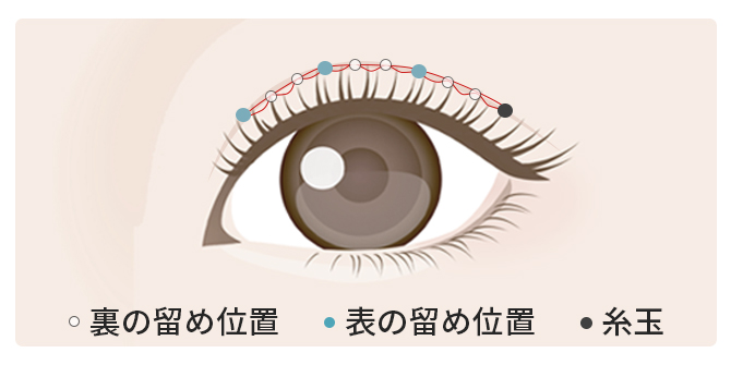ハイブリッドクロス法（裏表10点留め）