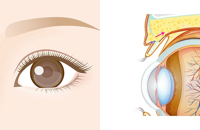 施術完了・アフターケア