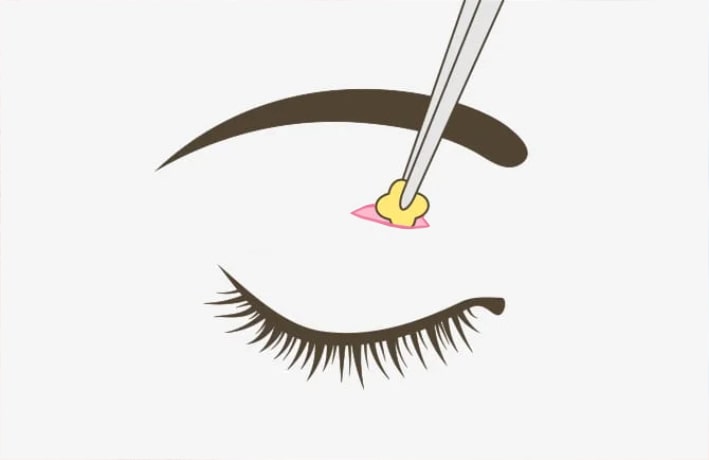 脂肪も一緒にとれる