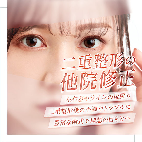 二重整形・眼瞼下垂治療の他院修正