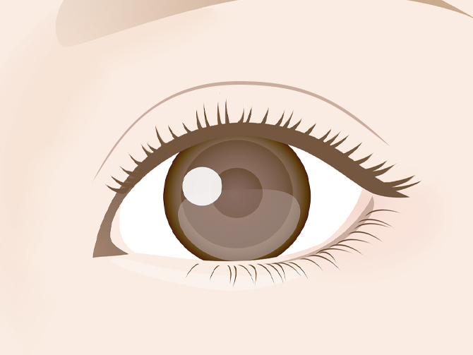 二重幅が広すぎる