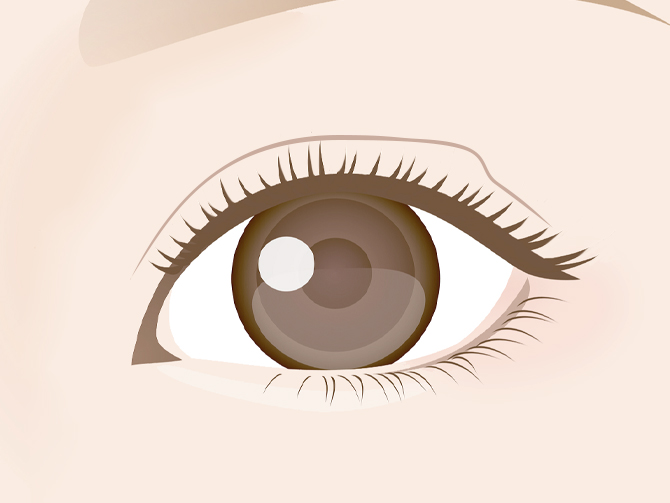 二重ラインの歪み