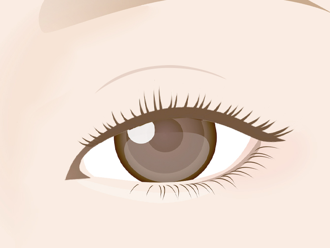 一重に戻った・目の開きが悪い