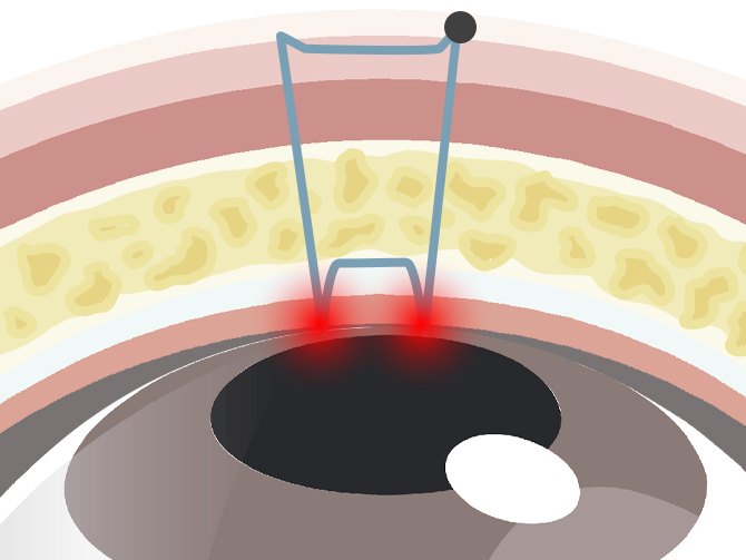 目がゴロゴロする・痛い