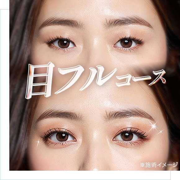 目フルコース（バンビ目整形・アーモンドアイ）