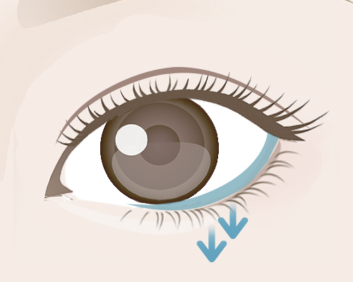 グラマラスライン