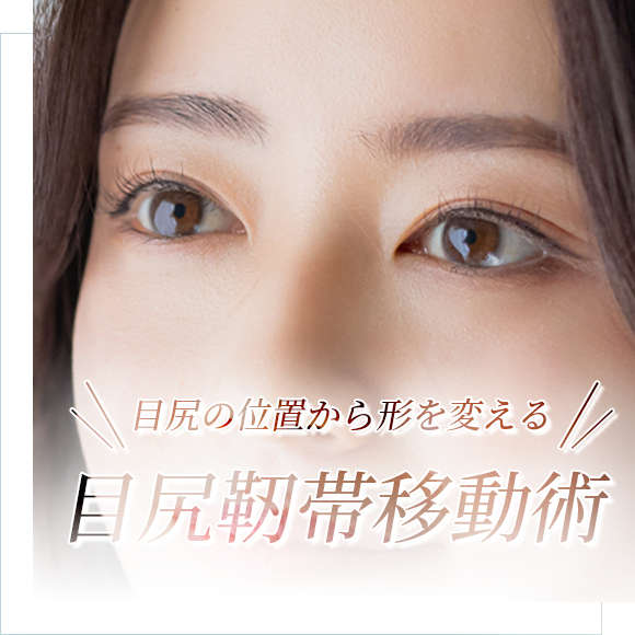 目尻靭帯移動術(目尻外眼角靭帯移動術)