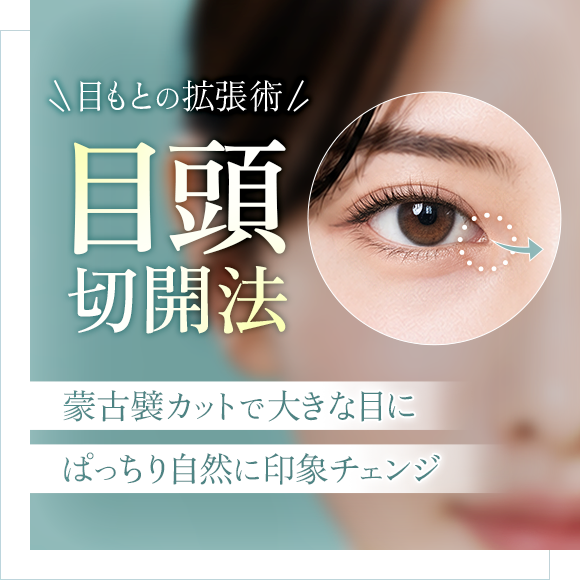 目頭切開法