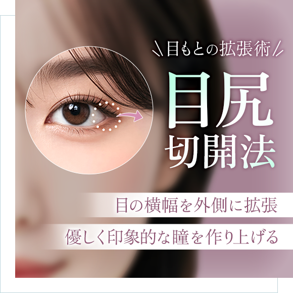 目尻切開法